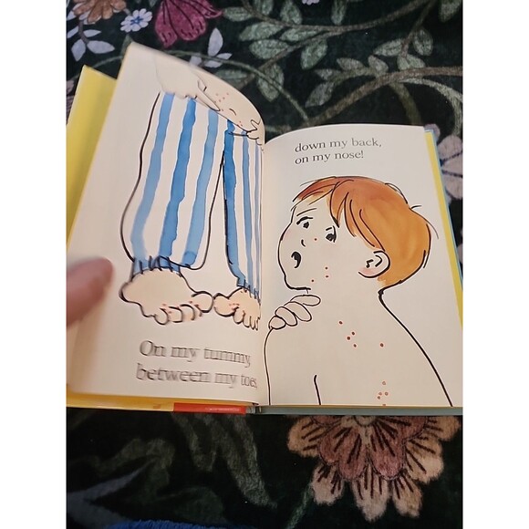 VINTAGE 1992 Itchy, Itchy Chicken Pox Scholastic Book Children Reading Education - Picture 8 of 10